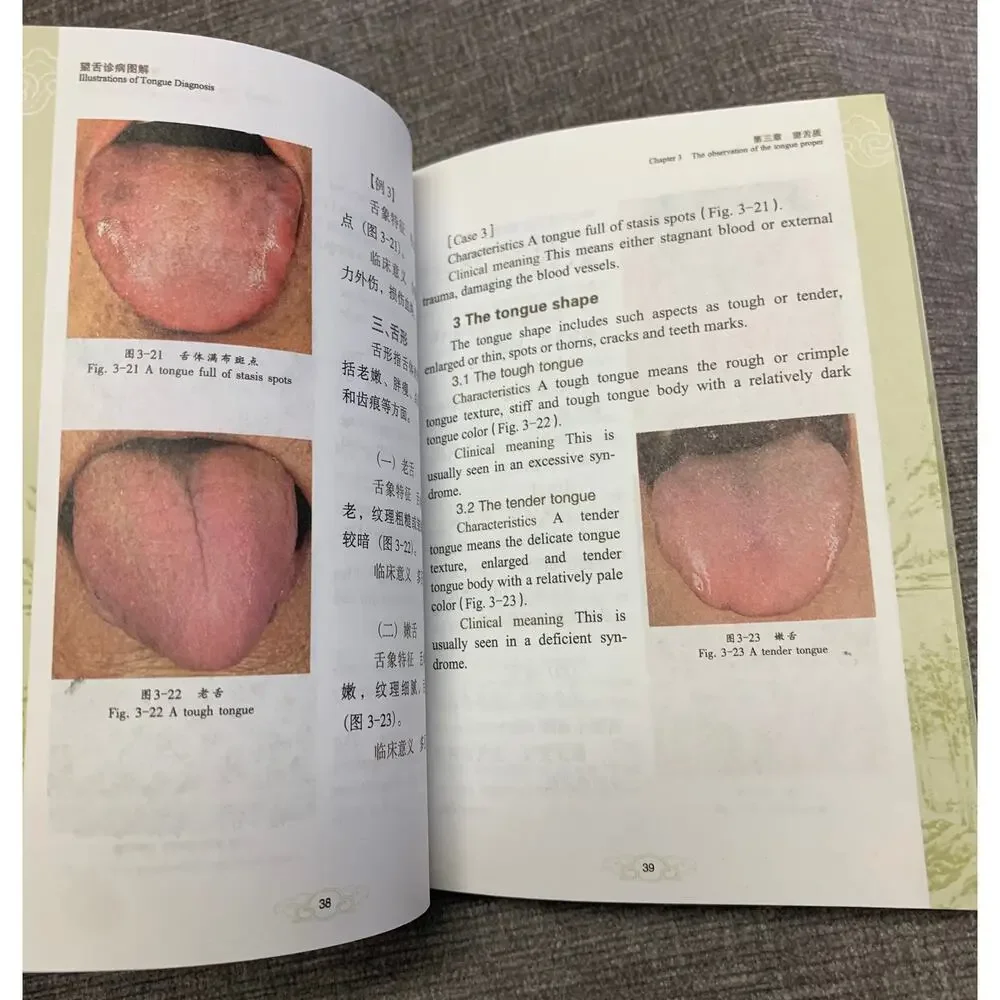 Illustrations of Tongue Diagnosis - Traditional Chinese Medicine TCM Pocket Edit